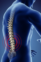 Low Back Pain