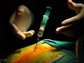 Spinal Cord and Peripheral Nerve Stimulation