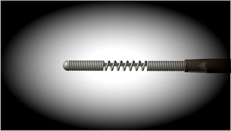 Neuroplasty – Adhesiolysis with Racz Catheter