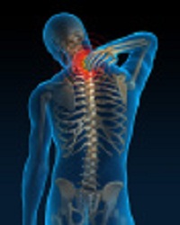 Cervical Facet Joint Syndrome