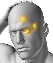 Cluster Headache