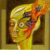 Migraine