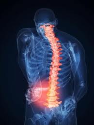 Sacroiliac Joint Dysfunction