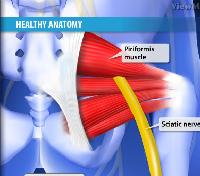 Piriformis Muscle Syndrome