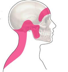Tension headache