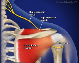 Suprascapular Nerve Entrapment Neuropathy