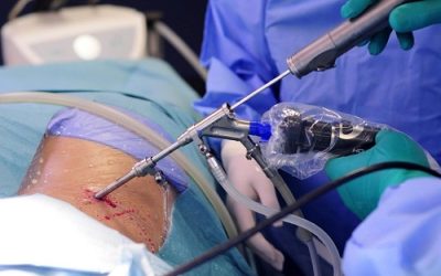 Ελάχιστα Επεμβατική Χειρουργική Σπονδυλικής Στήλης