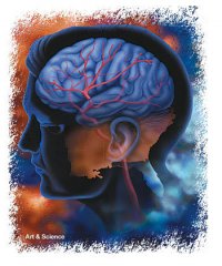 Central Post-Stroke Neuropathic Pain