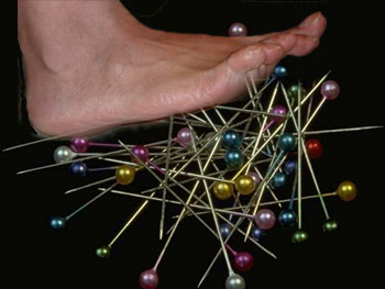 Peripheral Neuropathy